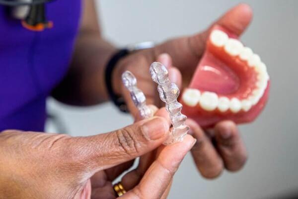 Invisalign Treatment